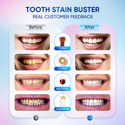 Niacinamide Dazzle White Toothpaste