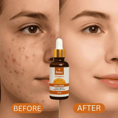 Relax UK Vitamin C Skin aging Face Serum