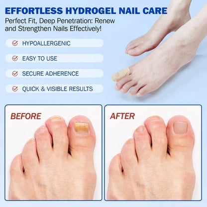Fungal Nail Treatment Patches