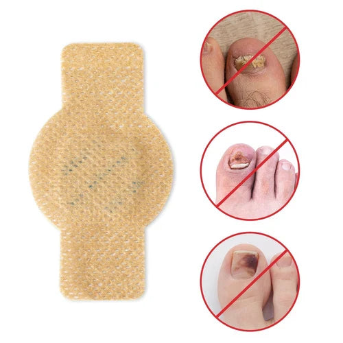 Fungal Nail Treatment Patches