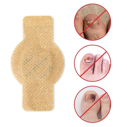 Fungal Nail Treatment Patches